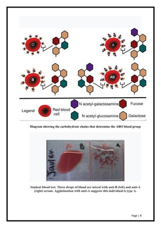 ABO Blood Grouping Biology Investigatory Project Class XII(12) | PDF