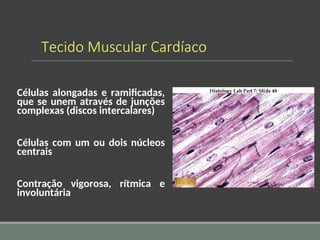 Tecido Muscular Cardíaco
Células alongadas e ramificadas,
que se unem através de junções
complexas (discos intercalares)
Células com um ou dois núcleos
centrais
Contração vigorosa, rítmica e
involuntária
 