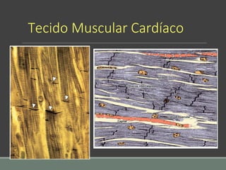 Tecido Muscular Cardíaco
 