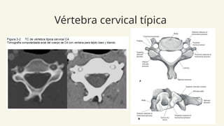 Anatomia Columna normal e inestable Neuroanatomia | PPTX