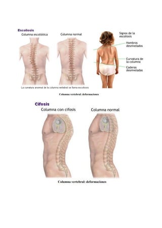 1.4 Sistema Esquelético Huesos      .pdf
