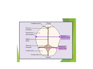 intranatal period during delivery ...... | PPTX