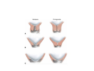 intranatal period during delivery ...... | PPTX