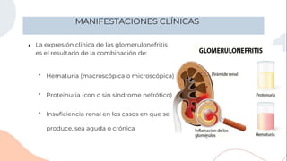 MANIFESTACIONES CLÍNICAS
●
produce, sea aguda o crónica
La expresión clínica de las glomerulonefritis
es el resultado de la combinación de:
Insuficiencia renal en los casos en que se
Proteinuria (con o sin síndrome nefrótico)
Hematuria (macroscópica o microscópica)
▪
▪
▪
 