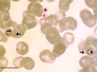 Vivax trophozoite
 
