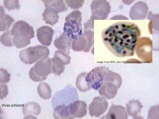 Vivax schizont
 