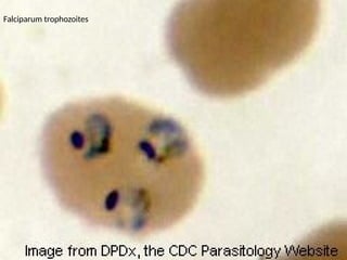 Falciparum trophozoites
 