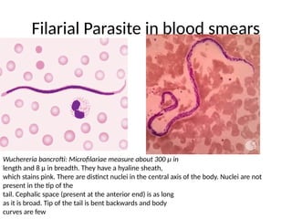 Filarial Parasite in blood smears
Wuchereria bancrofti: Microfilariae measure about 300 μ in
length and 8 μ in breadth. They have a hyaline sheath,
which stains pink. There are distinct nuclei in the central axis of the body. Nuclei are not
present in the tip of the
tail. Cephalic space (present at the anterior end) is as long
as it is broad. Tip of the tail is bent backwards and body
curves are few
 
