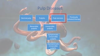 Pulp Diseases
 