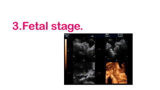 3.Fetal stage.
 