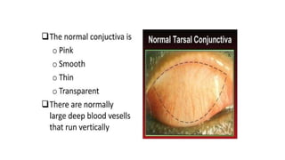 2.anatomy of conj.pptx anatomy of conjunctiva | PPTX