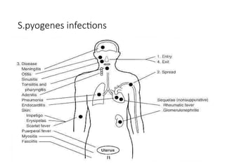 S.pyogenes infections
 