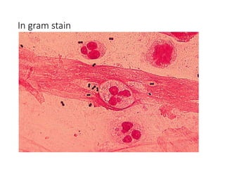 In gram stain
 
