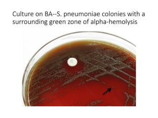 Culture on BA--S. pneumoniae colonies with a
surrounding green zone of alpha-hemolysis
 