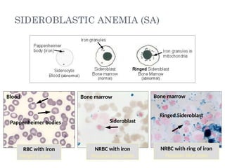 Iron Left In Rbc 2. Disorder of RBC (Anemia and polycythemia).pptx