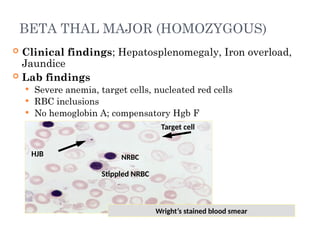 Stained Rbc Slides 2. Disorder of RBC (Anemia and polycythemia).pptx