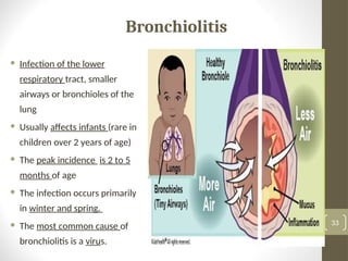 Broncholite 2. Children with the Respiratory Dysfunction (3).ppt