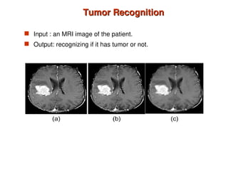 Tumor Recognition
Tumor Recognition
 Input : an MRI image of the patient.
 Output: recognizing if it has tumor or not.
 