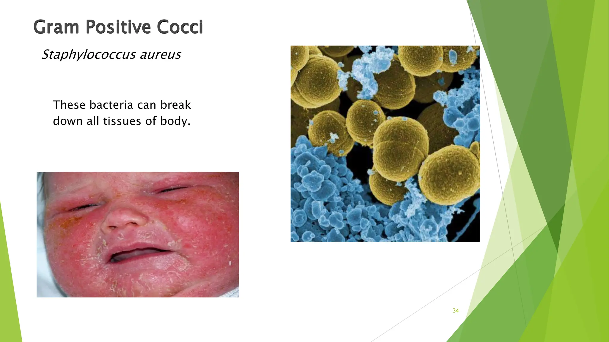 Gram Positive Cocci
Staphylococcus aureus
These bacteria can break
down all tissues of body.
34
 