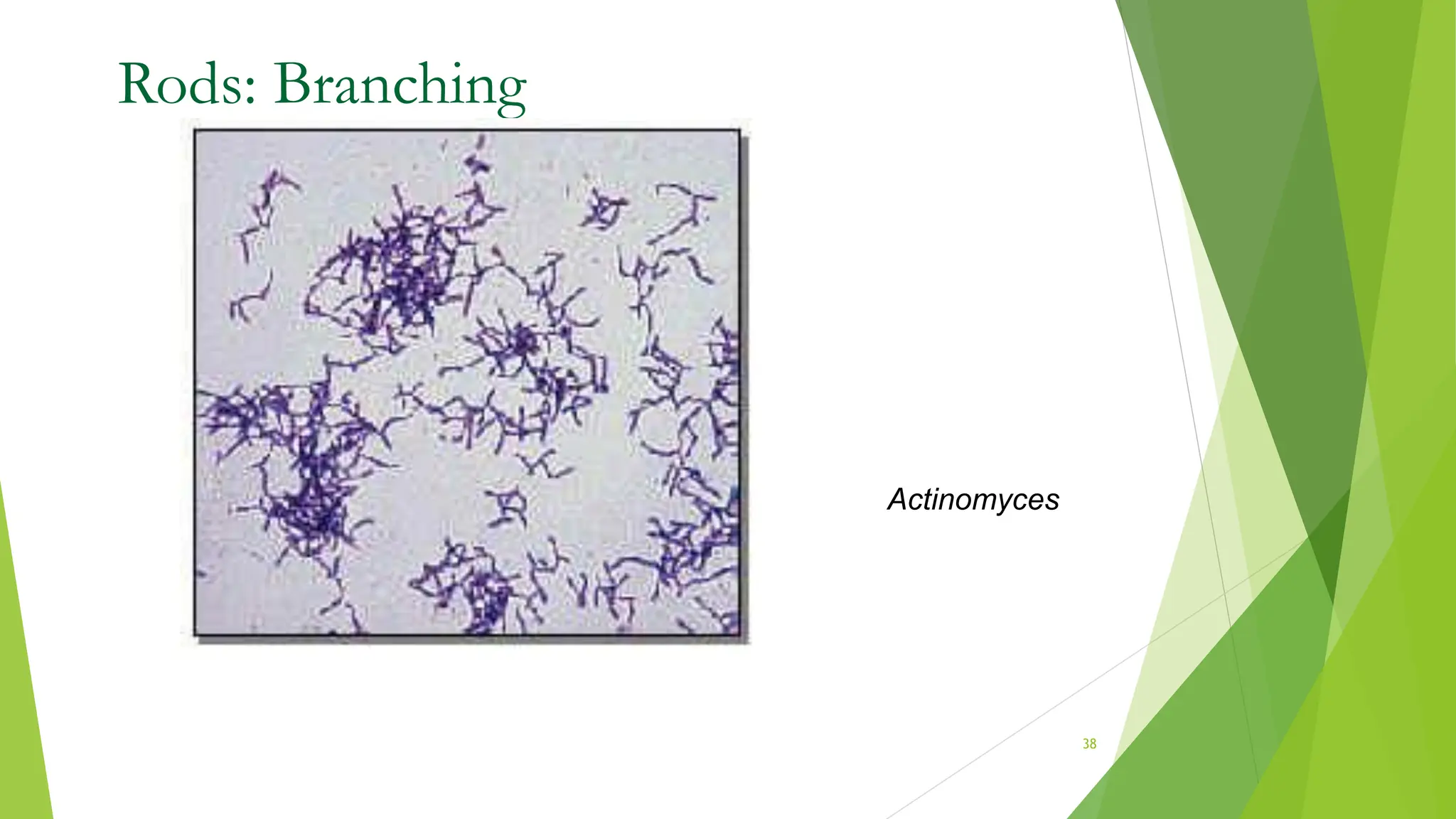 Rods: Branching
Actinomyces
38
 