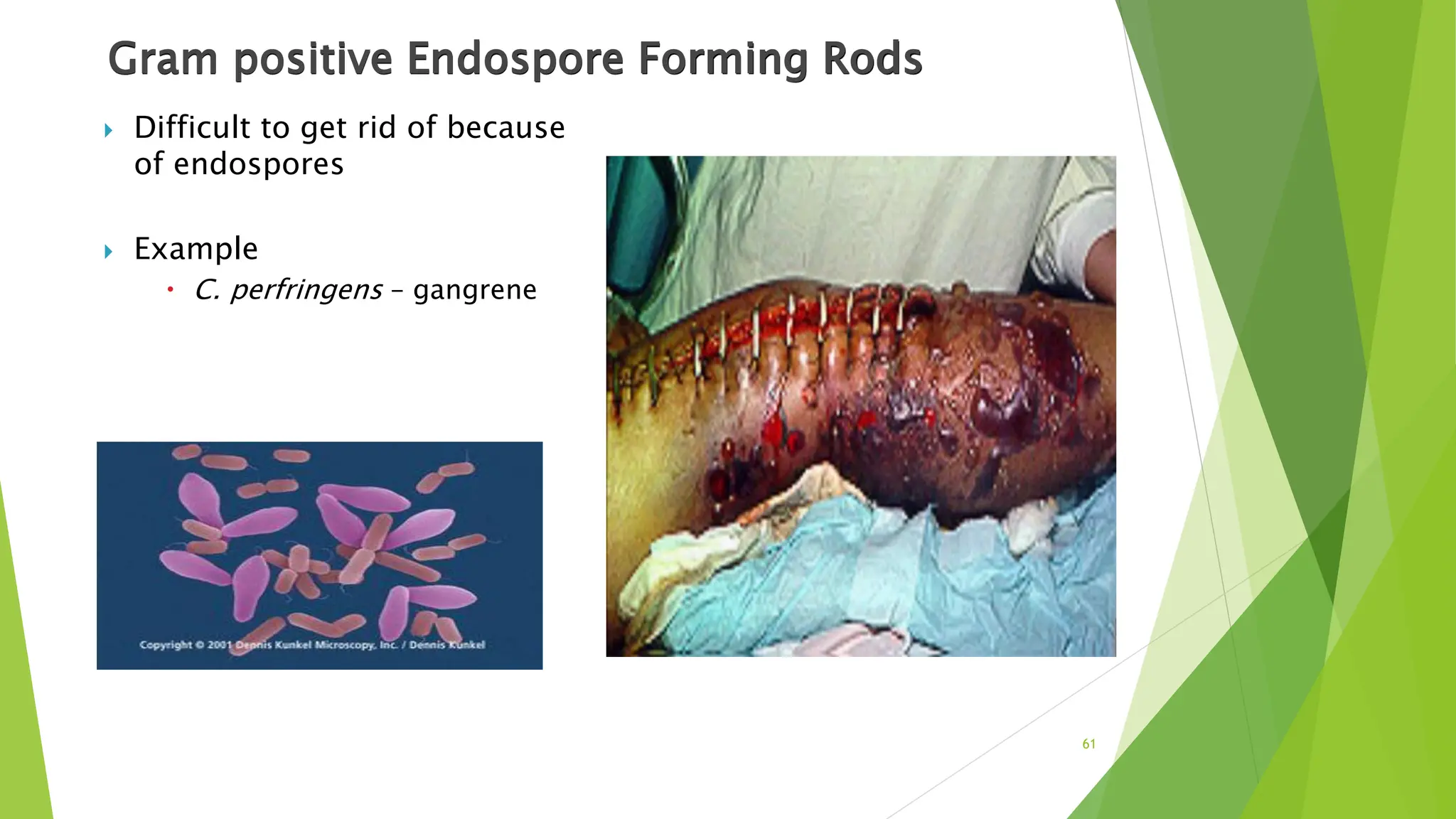 Gram positive Endospore Forming Rods
 Difficult to get rid of because
of endospores
 Example
 C. perfringens – gangrene
61
 
