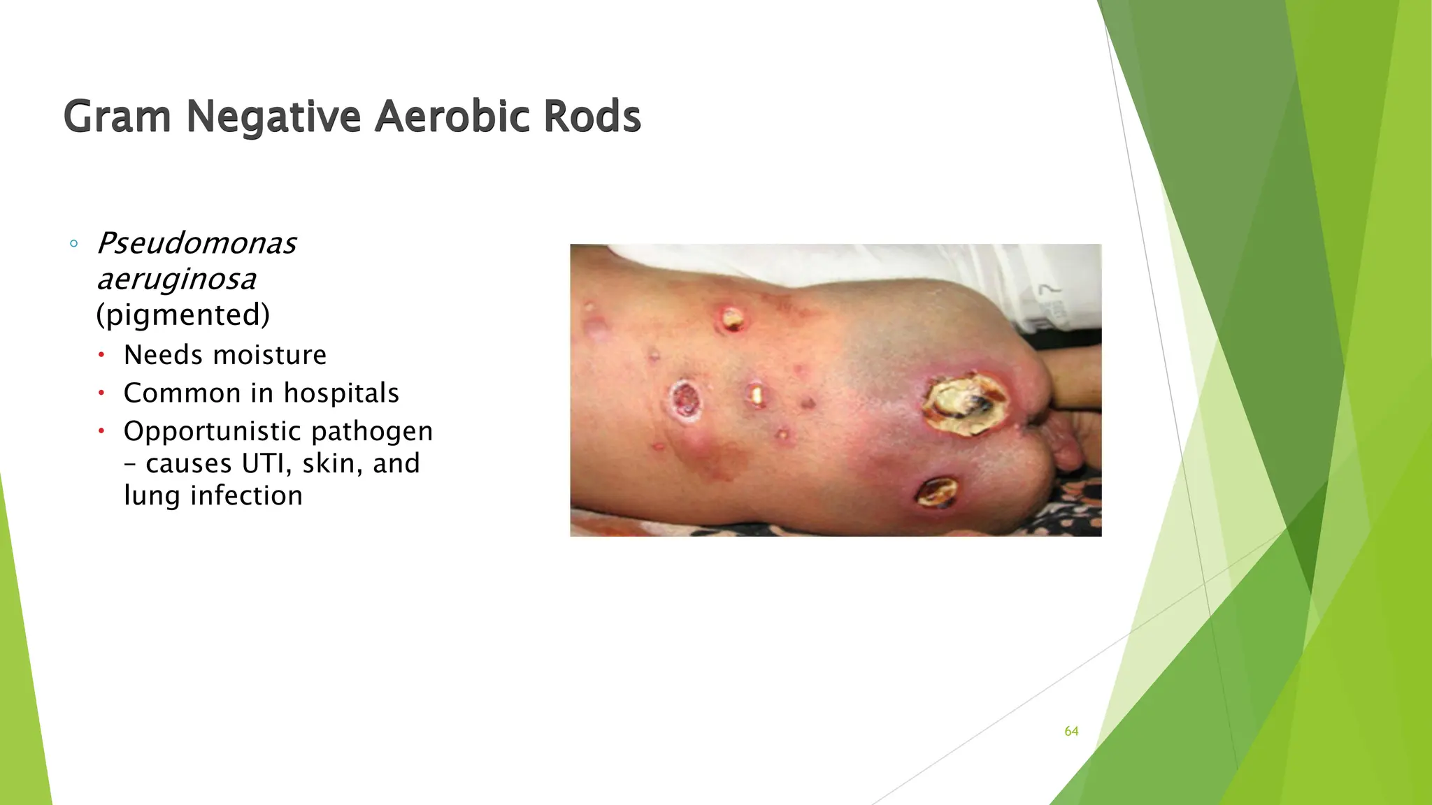 Gram Negative Aerobic Rods
◦ Pseudomonas
aeruginosa
(pigmented)
 Needs moisture
 Common in hospitals
 Opportunistic pathogen
– causes UTI, skin, and
lung infection
64
 