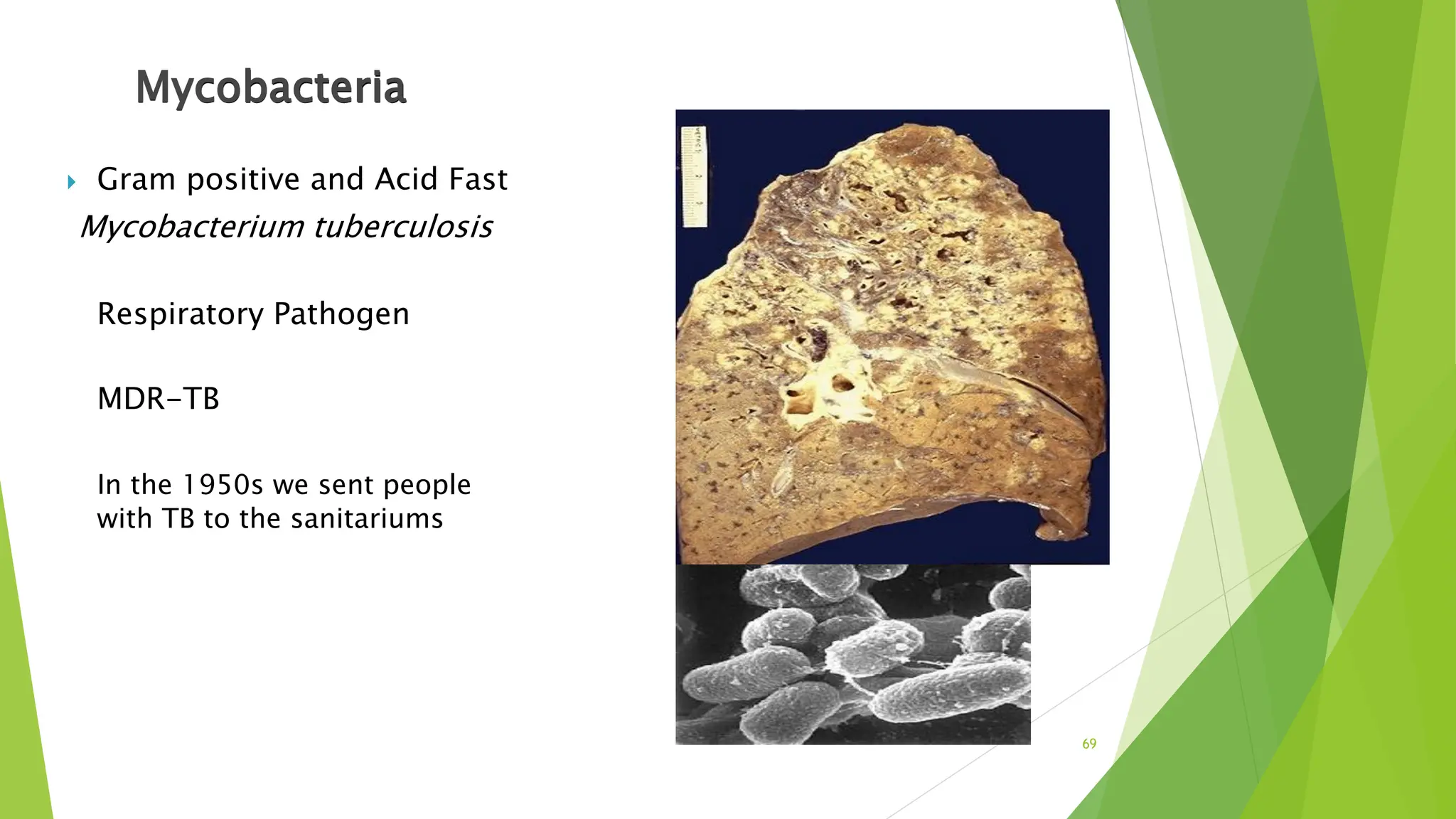 Mycobacteria
 Gram positive and Acid Fast
Mycobacterium tuberculosis
Respiratory Pathogen
MDR-TB
In the 1950s we sent people
with TB to the sanitariums
69
 