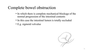 Complete bowel obstruction
• In which there is complete mechanical blockage of the
normal progression of the intestinal contents
• In this case the intestinal lumen is totally occluded
• E.g. sigmoid volvulus
21
 