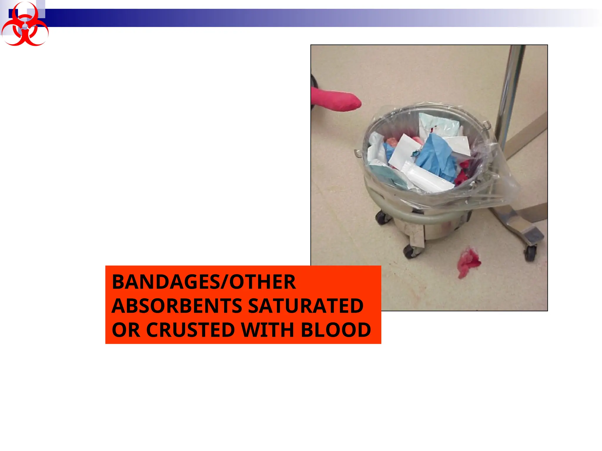 BANDAGES/OTHER
ABSORBENTS SATURATED
OR CRUSTED WITH BLOOD
 