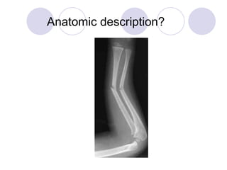 Anatomic description?
 