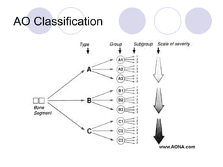 AO Classification
 