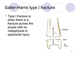 Salter-Harris type I fracture
Type I fracture is
when there is a
fracture across the
physis with no
metaphysial or
epiphysial injury
 