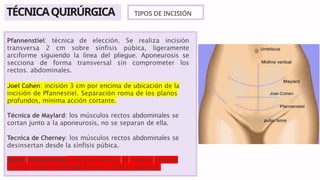 Presentacion sobre cesarea orientado a educacion en medicina chile | PPTX
