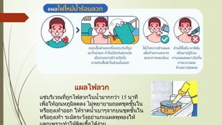 แผลไฟลวก
แช่บริเวณที่ถูกไฟลวกในน้ำมากกว่า 15 นาที
เพื่อให้อุณหภูมิลดลง ไม่พยายามถอดชุดชั้นใน
หรือถุงเท้าออก ให้ราดน้ำเบาๆจากบนชุดชั้นใน
หรือถุงเท้า ระมัดระวังอย่าแกะแผลพุพองให้
 