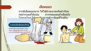 เลือดออก
หากมีเลือดออกมาก ให้ใช้ผ้าสะอาดหรือผ้าก๊อซ
กดปากแผลให้แน่น หากกดแผลแล้วเลือดยัง
ไม่หยุดไหล ให้กดบริเวณจุดห้ามเลือดที่ใกล้กับ
หัวใจ
 