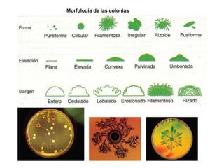 Morfología de las colonias
 
