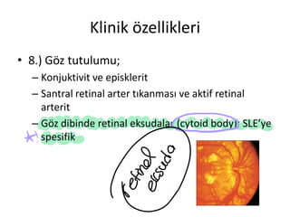 2. Sistemik Lupus Eritematozus ve Antifosfolipid Antikor Sendromu.pdf