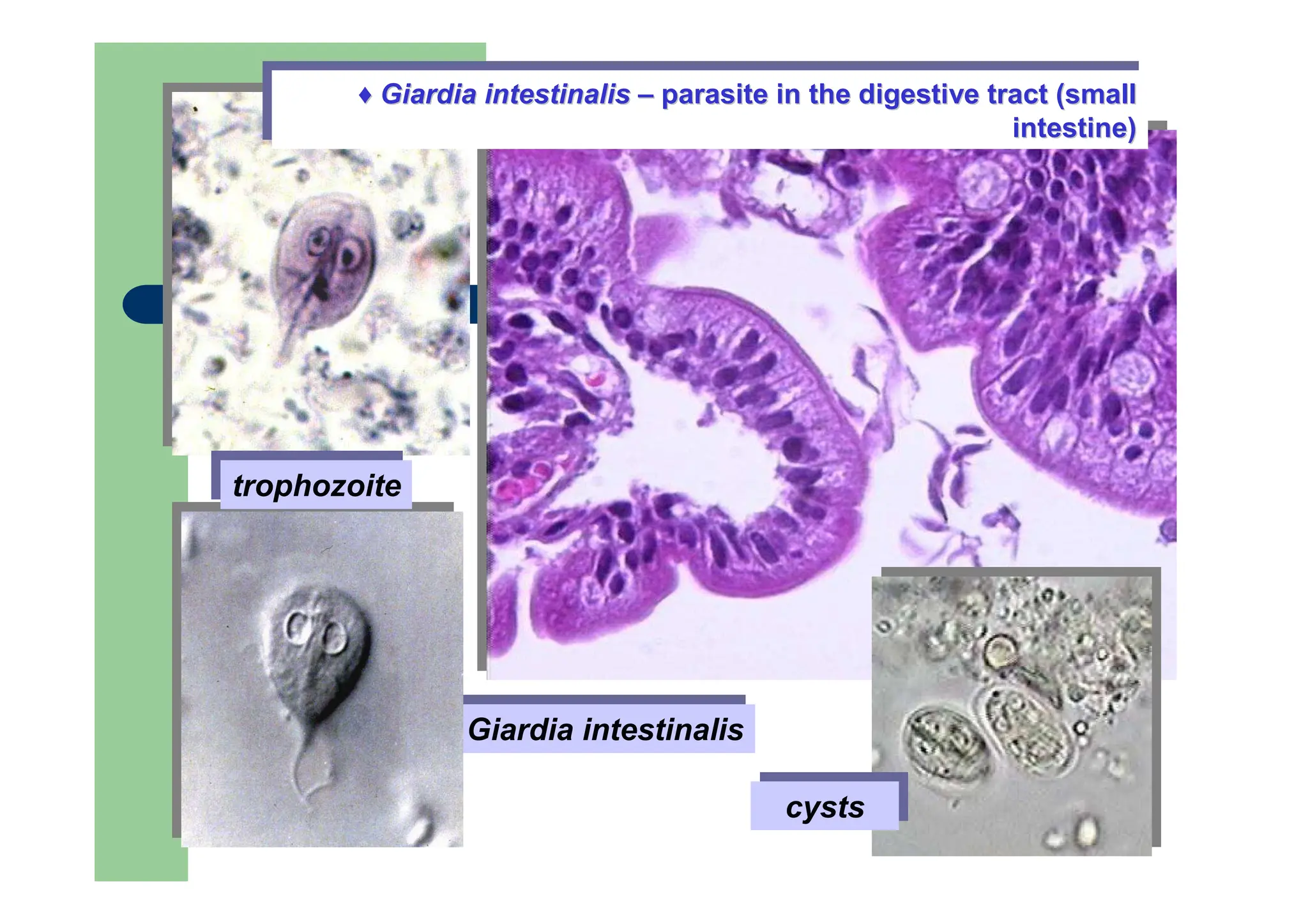 Giardia intestinalis
Giardia intestinalis
trophozoite
trophozoite
cysts
cysts
♦ Giardia intestinalis – parasite in the digestive tract (small
intestine)
♦
♦ Giardia
Giardia intestinalis
intestinalis –
– para
parasite in the digestive tract (small
site in the digestive tract (small
intestine)
intestine)
 