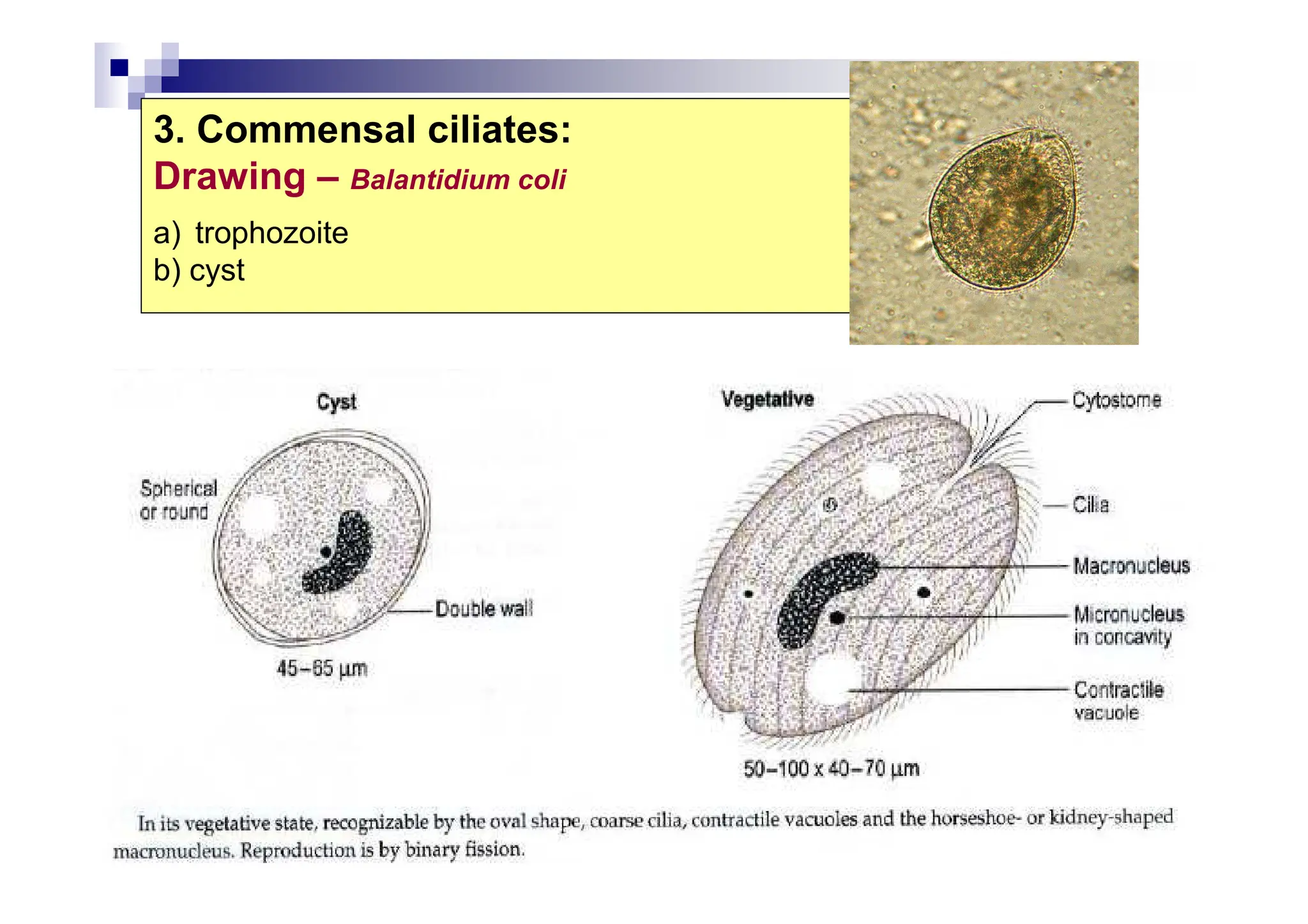 3. Commensal ciliates:
Drawing – Balantidium coli
a) trophozoite
b) cyst
 