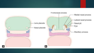 Development of face and anomalies- embryology.pptx