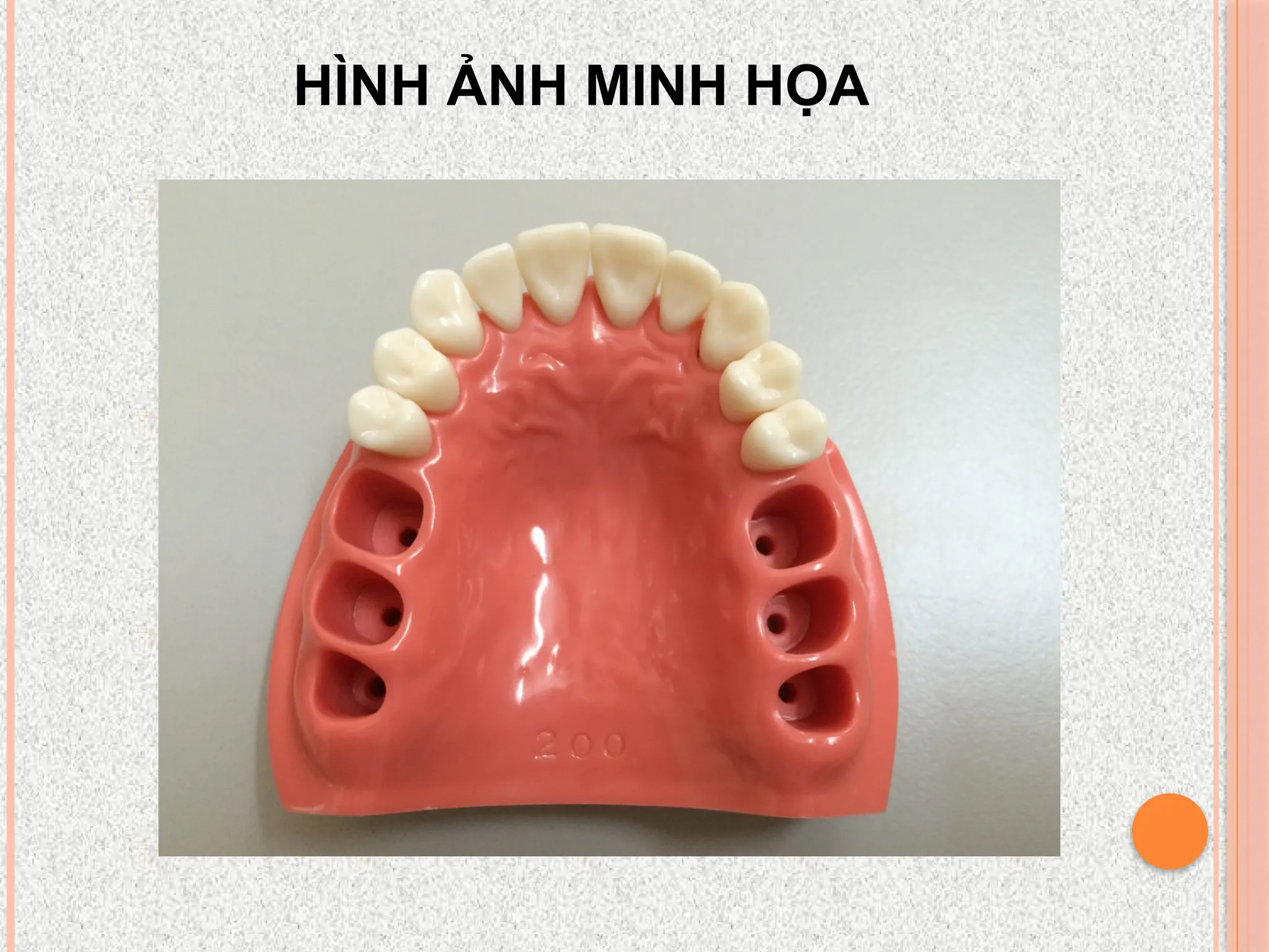 HÌNH ẢNH MINH HỌA
 