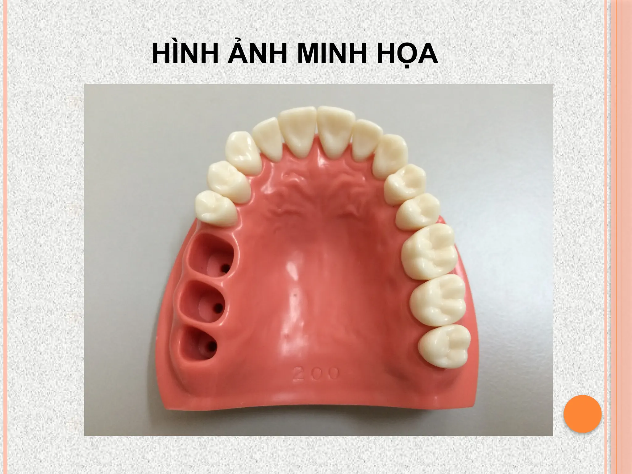 HÌNH ẢNH MINH HỌA
 