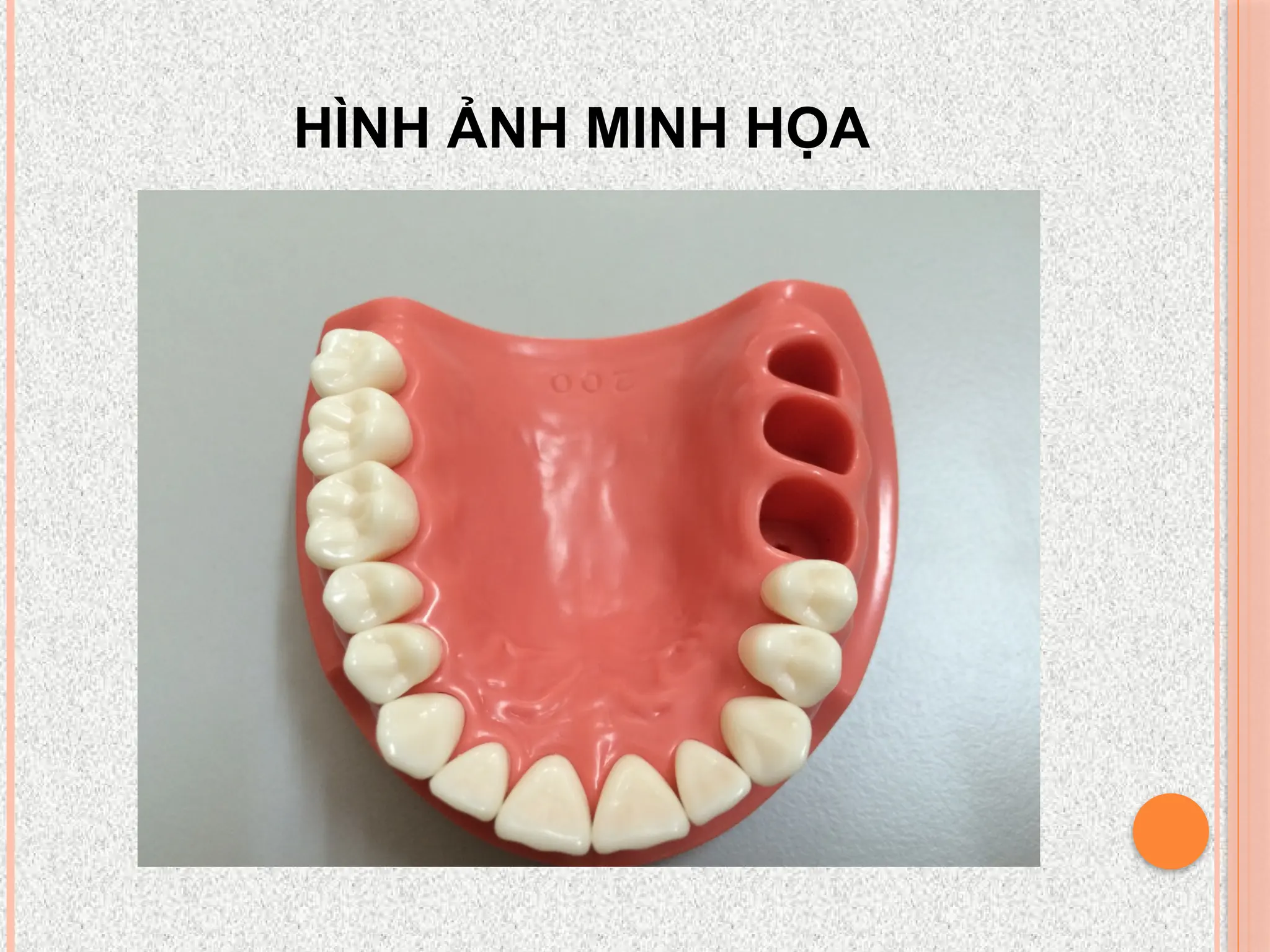 HÌNH ẢNH MINH HỌA
 