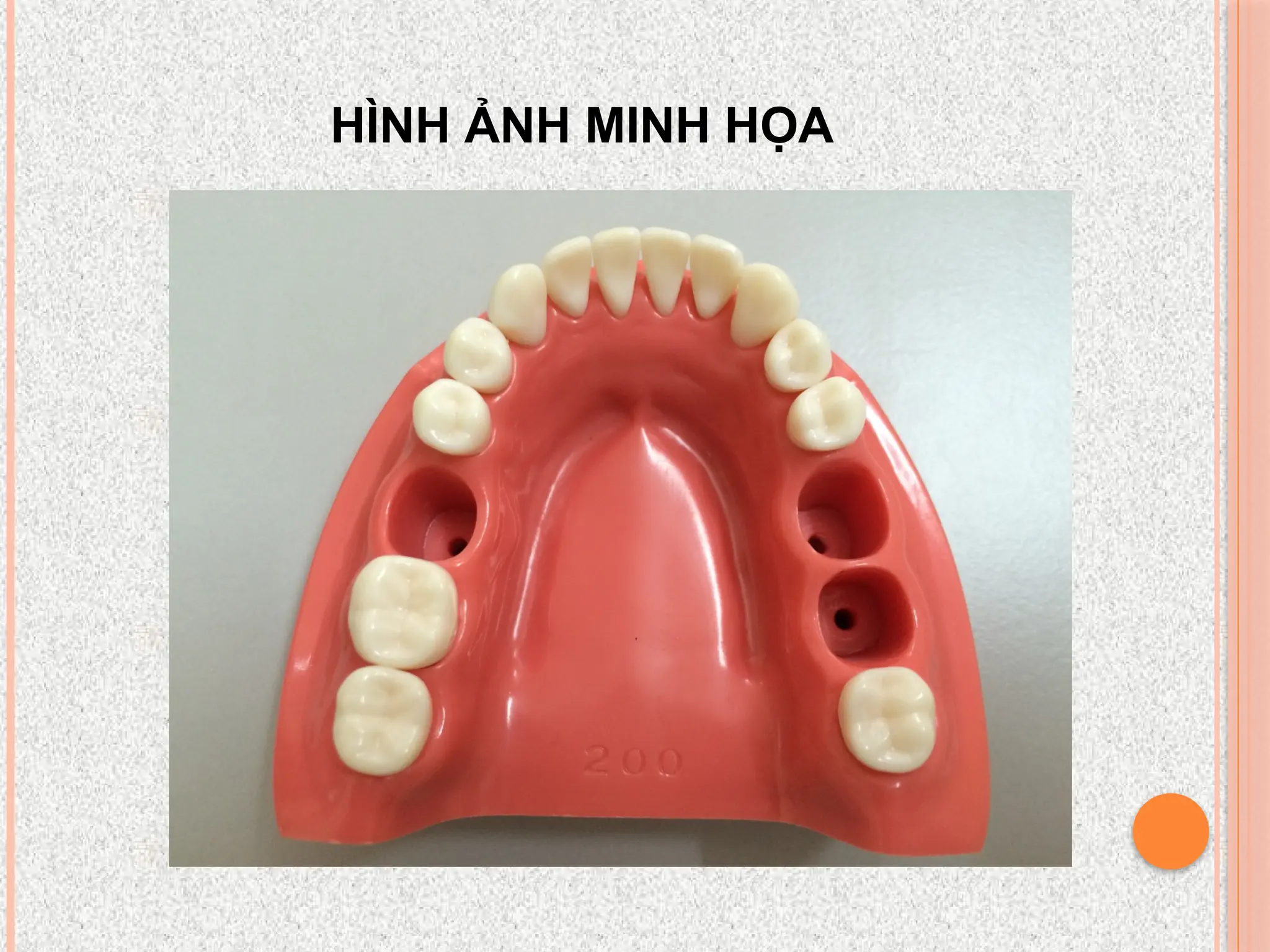 HÌNH ẢNH MINH HỌA
 