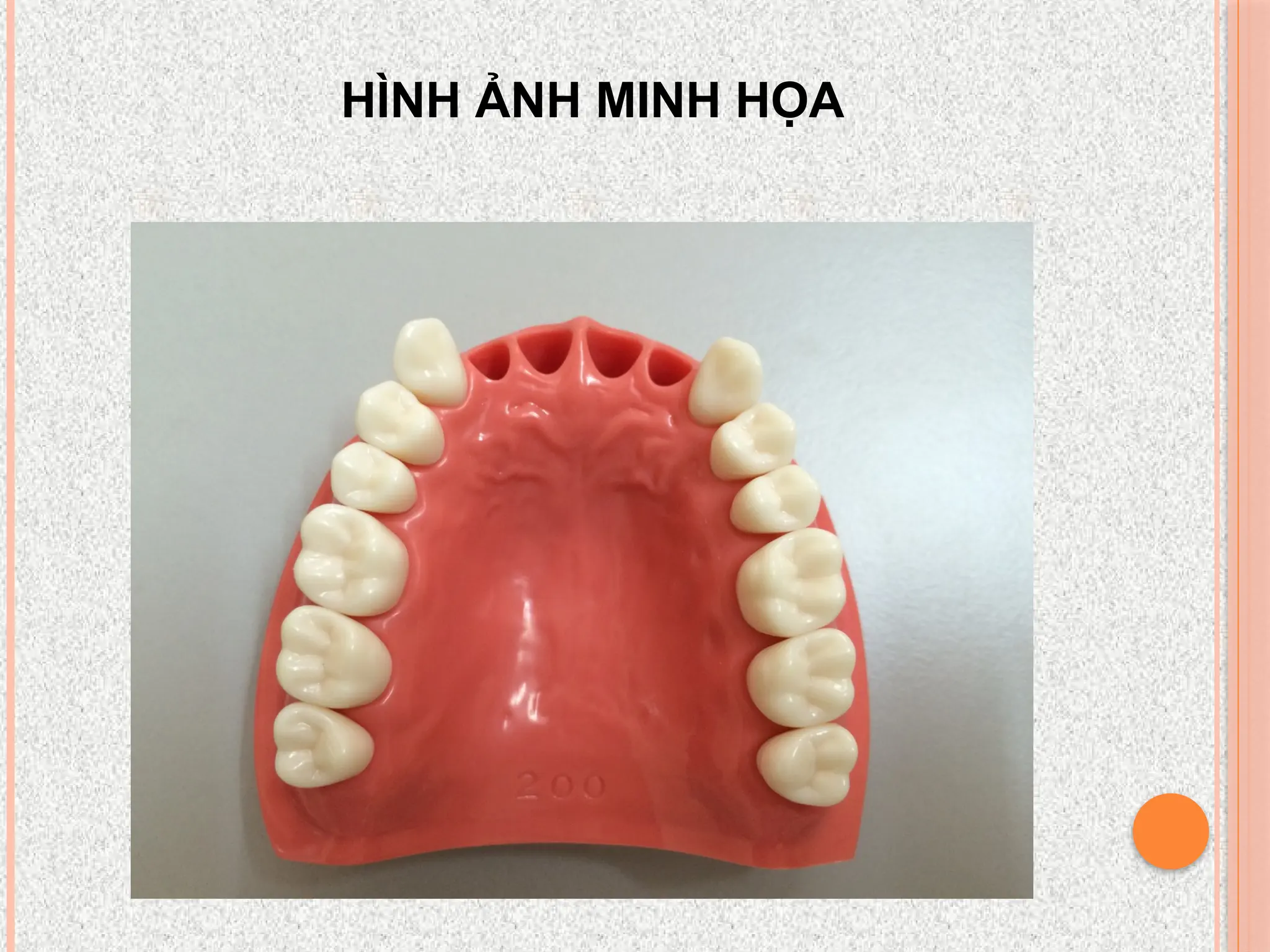 HÌNH ẢNH MINH HỌA
 