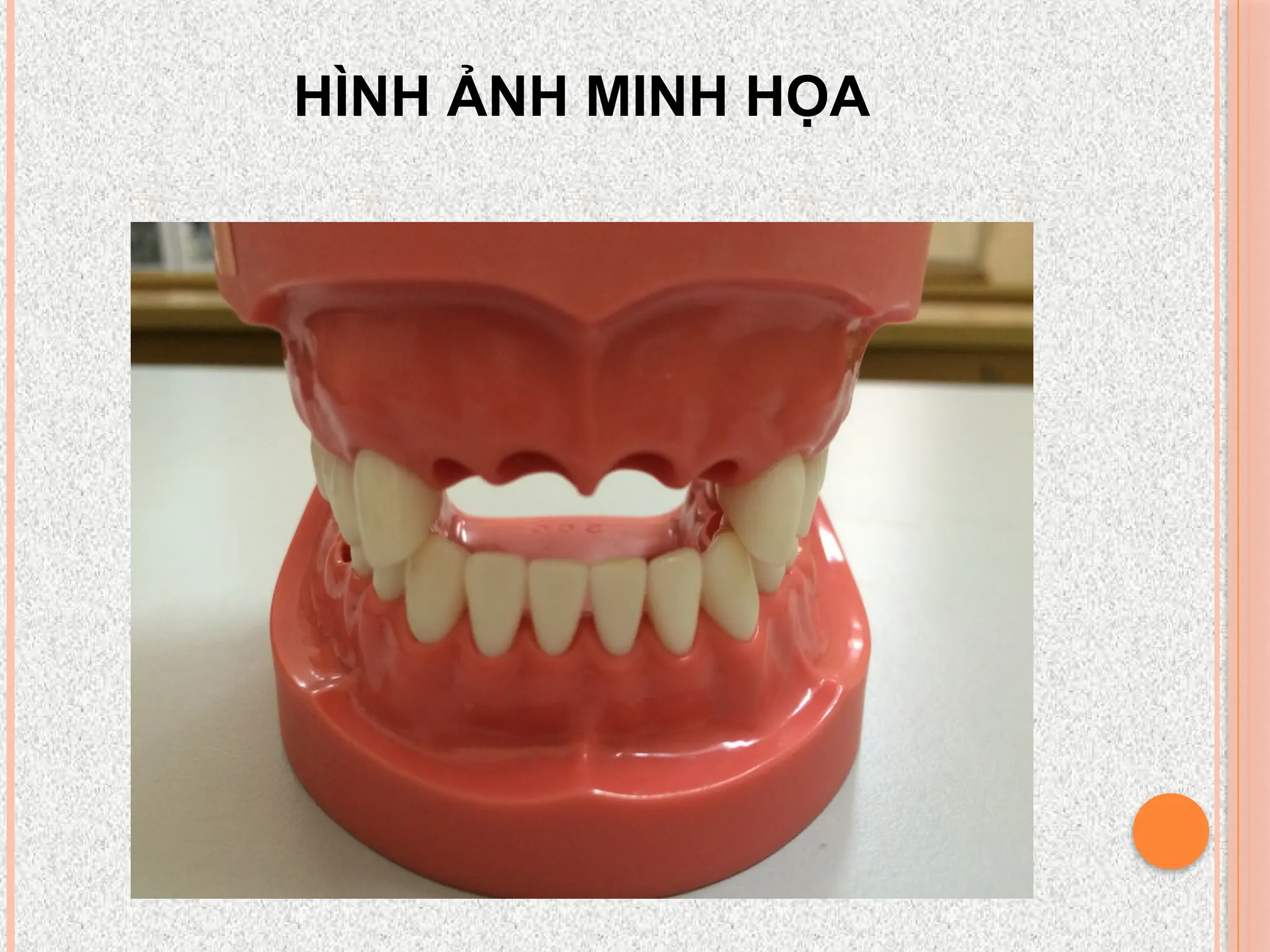 HÌNH ẢNH MINH HỌA
 