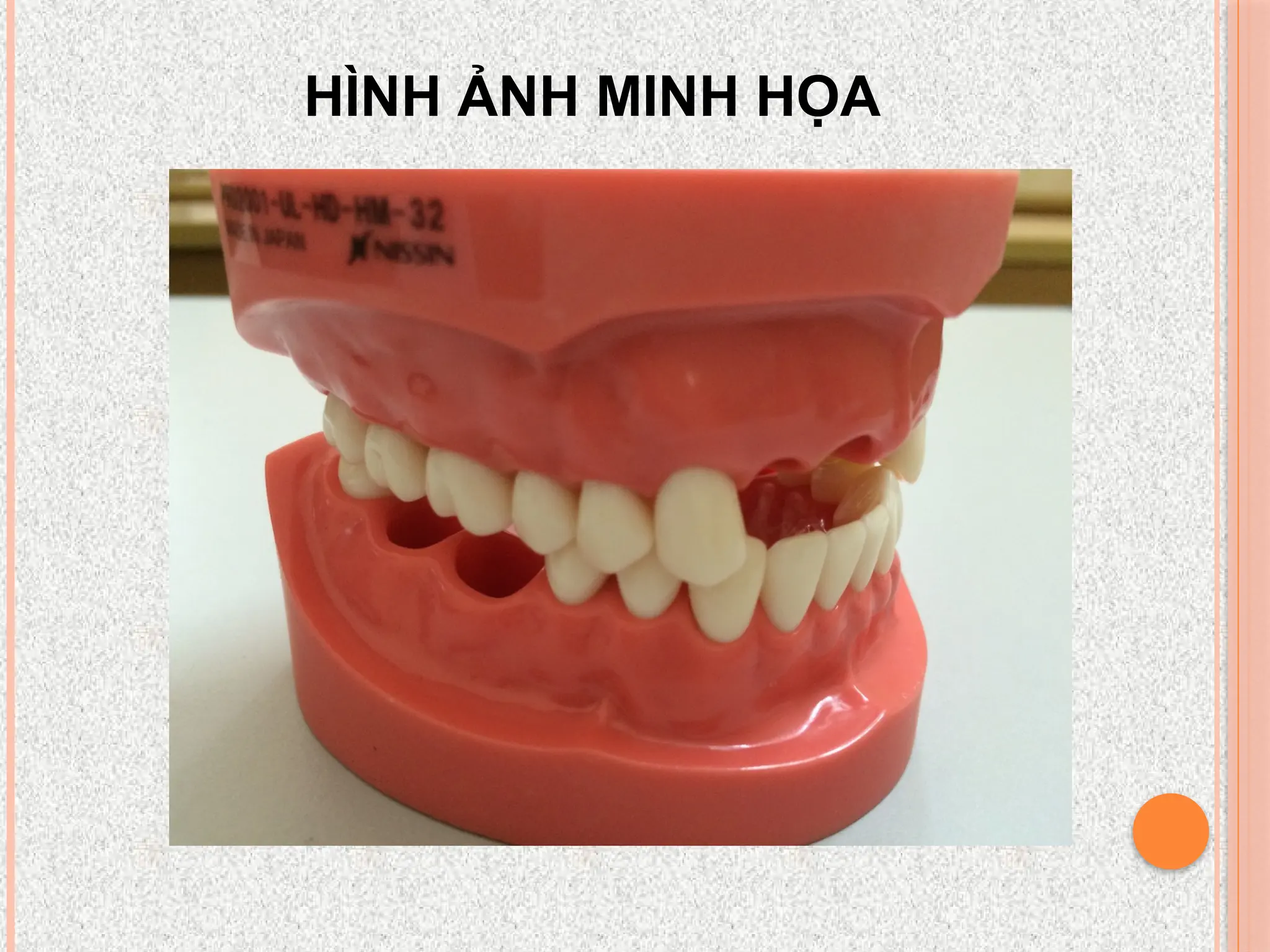 HÌNH ẢNH MINH HỌA
 