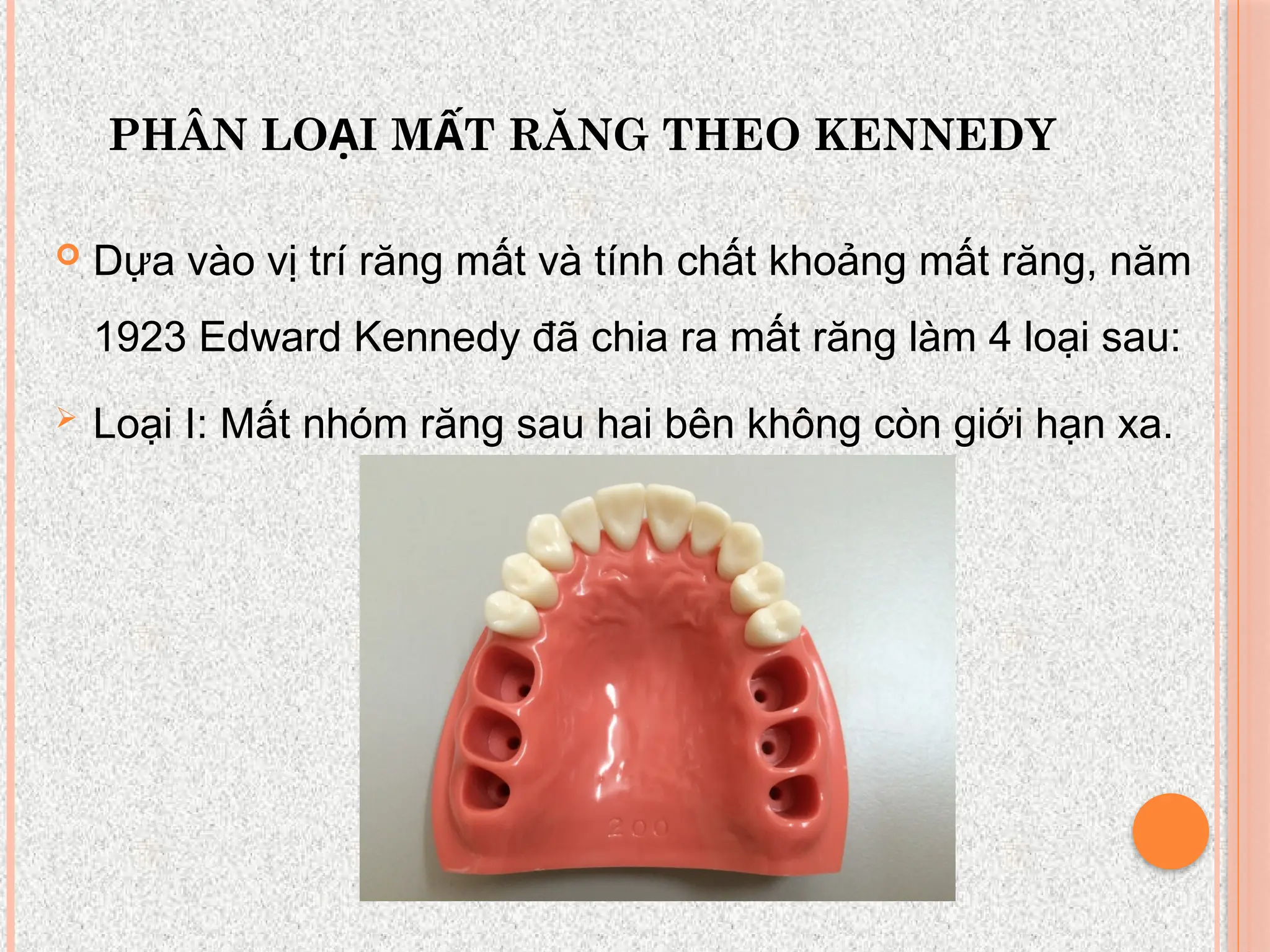 PHÂN LO I M T RĂNG THEO KENNEDY
Ạ Ấ
 Dựa vào vị trí răng mất và tính chất khoảng mất răng, năm
1923 Edward Kennedy đã chia ra mất răng làm 4 loại sau:
 Loại I: Mất nhóm răng sau hai bên không còn giới hạn xa.
 
