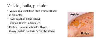 2. Terminology of skin lesions slide share.pptx