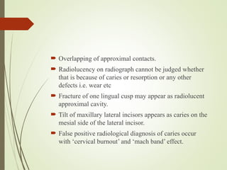 2. CARIES- DIAGNOSIS & RISK ASSESMENT - 16.pptx